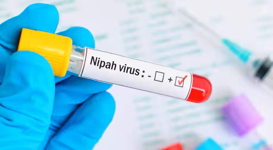 nipah-virus